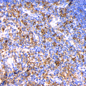 03 GB115427 20230323_CD74_C2803 03_C280322110203_M thymus gland  d800_40.0x_IHC.jpg