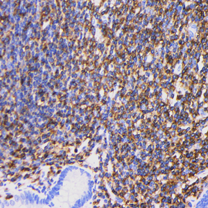 02 GB115428 20230323_CD45_C2460 03_C246022101803_H lymph node d300_40.0X_IHC.jpg