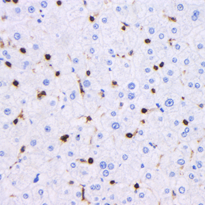 03 GB115428 20230323_CD45_C2460 03_C246022101803_H liver d300_40.0X_IHC.jpg