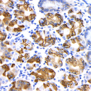 01 GB12114 20230320_muc6_7B2B6_7B2B6 20230220 H gastric carcinoma TMA d1000_IHC.jpg