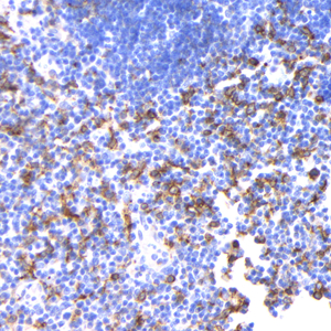 07 GB115427 20230323_CD74_C2803 03_C280322110203_R thymus gland  d800_40.0x_IHC.jpg