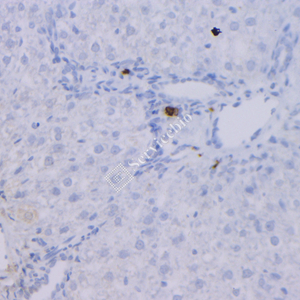 03 GB12093_20230420_GranzymeB_7G5G5_7G5G5 20230313 R liver d1000_IHC-2.jpg