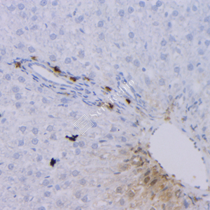 04 GB12093_20230420_GranzymeB_7G5G5_7G5G5 20230313 R liver d1000_IHC-1.jpg
