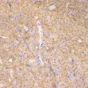 03 GB15094_20230419_GAP43_H51_H5120230403 M spinal marrow d1000_40.0x_IHC.jpg