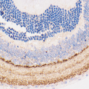 04 GB15094_20230419_GAP43_H51_H5120230403 M Retina d1000_40.0x_IHC.jpg