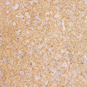 05 GB15094_20230419_GAP43_H51_H5120230403 M Brain d1000_40.0x_IHC.jpg