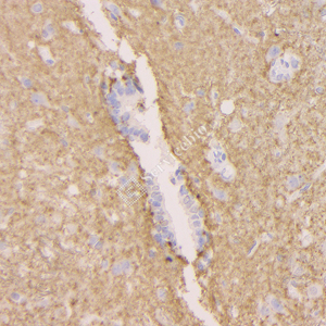 06 GB15094_20230419_GAP43_H51_H5120230403 R spinal marrow d1000_40.0x_IHC.jpg