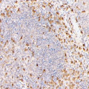 03 GB15398_20230419_S100A4_C45_C4520230403 M spleen d1200_40.0x_IHC.jpg