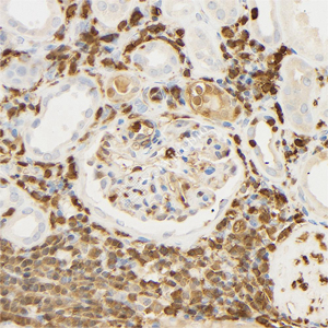05 GB15398_20230419_S100A4_C45_C4520230403 H kidney d1200_40.0x_IHC.jpg