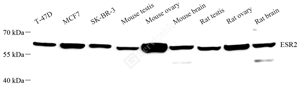 01 GB115454_C2841 ESR2_WB_WM.jpg