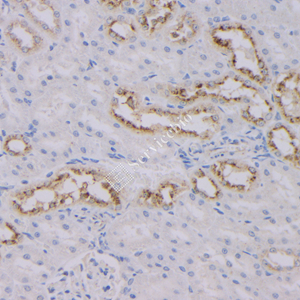 05 GB121011_20230420_NapsinA_3C2E4_3C2E4 20230304 R kidney d1000_IHC.jpg