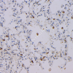 06 GB121011_20230420_NapsinA_3C2E4_3C2E4 20230304 M pneumonia d1000_IHC.jpg