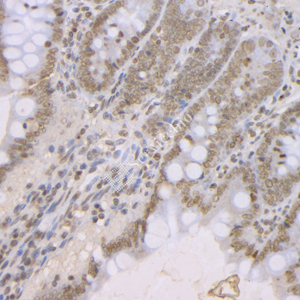 04 GB121957_20230420_MLH1_3C1A7_3C1A7 20230220 R small intestine d1000_IHC.jpg