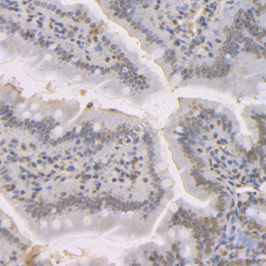 05 GB121957_20230420_MLH1_3C1A7_3C1A7 20230220 M small intestine d1000_IHC.jpg