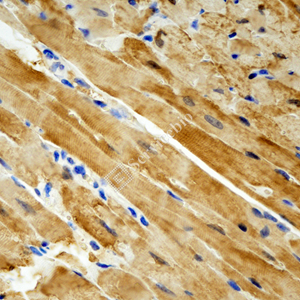 03 GB115461_20230423_myoglobin_14273_2 M heart d200_IHC.jpg