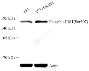 C2707 Phospho-IRS1(Ser307)_WB(2).jpg