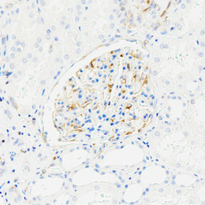 Anti-VEGFA Rabbit mAb