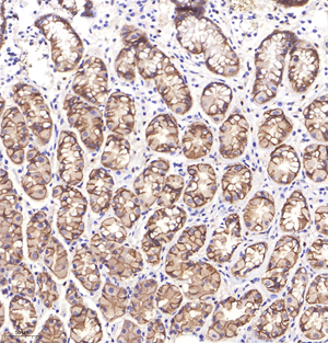 02 GB11015_catenin_H stomach d1500_40.0x_IHC.jpg