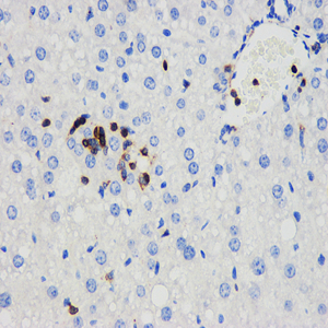 01 GB11066_20150101_CD45_4047_404715090801 M liver d4000_40.0x_IHC.jpg