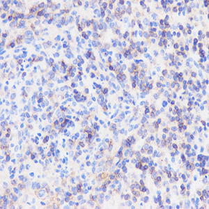 03 GB11066_20150101_CD45_4047_404715090801 M spleen+LPS d4000_40.0x_IHC.jpg