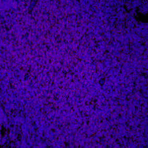 04 GB11066_20150101_CD45_4047_404715090801 M lymph node+LPS d4000_20.0x_IF.jpg