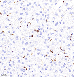 03 GB11067_CD68_7816071201 R liver d300_40.0x_IHC.jpg