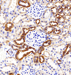 06 GB11080_Cytochrome C_7116070501 R kidney d2000_30.0x_IHC.jpg