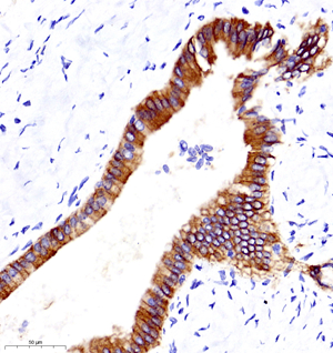 04 GB11082_E-cadherin_032_3216060701 H liver d500_35.0x_IHC.jpg