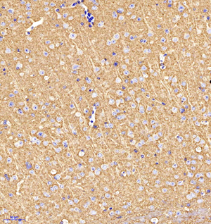 02 GB11095_GAP43_009160511202 M brain d200_20.0x_IHC.jpg