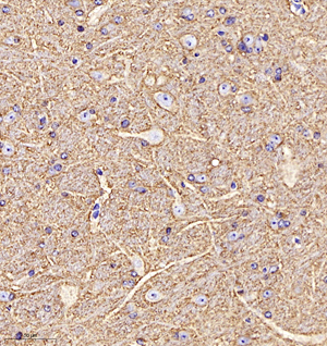 04 GB11095_GAP43_00916051201 R brain d200_30.0x_IHC.jpg