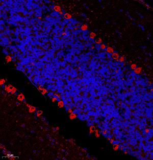 02 GB11098_GRP78_20220510 M cerebellum d1000_20.0x_IF.jpg