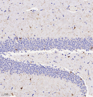 01 GB11105_Iba-1_101917101104 M brain d500_20.0x_IHC.jpg