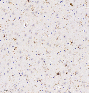 03 GB11105_Iba-1_101917101104 R brain d500_20.0x_IHC.jpg