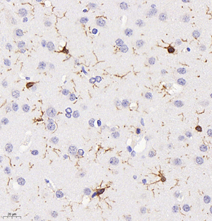 04 GB11105_Iba-1_101917101104 R brain d500_40.0x_IHC.jpg