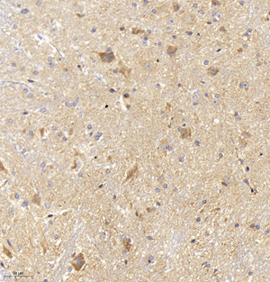 01 GB11119_inos_167_M spinal cord d500_20.0x_IHC.jpg