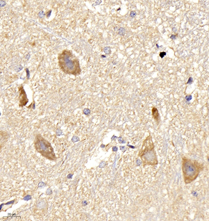 02 GB11119_iNOS_M spinal cord d500_40.0x_IHC.jpg