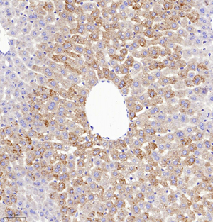 04 GB11130_mmp2_616051201 M liver d2000_20.0x_IHC.jpg