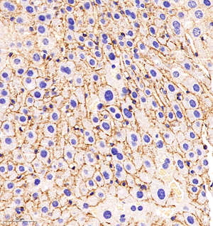 02 GB11135_N-Cadherin_21616120702 M liver+LPS d1600_30.0x_IHC.jpg