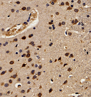 02 GB11153_170501_P21_142_14216100802 M brain d300_40.0x_IHC.jpg