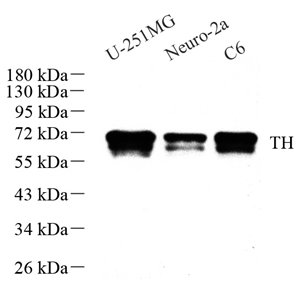 Anti-Tyrosine Hydroxylase Rabbit pAb