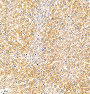 03 GB11188_TNFa_6007_M liver+LPS d400_20.0x_IHC.jpg