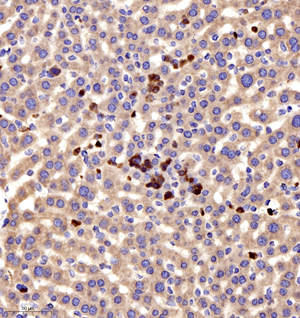 02 GB11199_MCP1_16116102502 M liver d500_30.0x_IHC.jpg