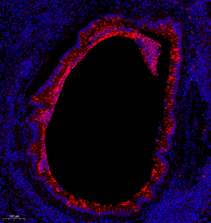 05 GB11199_MCP1_161_R lung d500_10.0x_IF.jpg