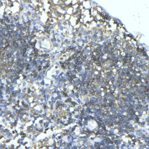 04  GB113886_20211125_CD45_C135821101203 R lymph node d300_40x_IHC.jpg