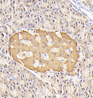 02 GB11334_170601_Insulin_576_57617041101 R pancreas d600_40.0x_IHC.jpg