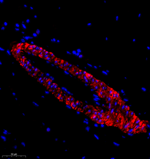 08 GB11366 SM22_170801 676_67617062102 SM22 M skeletal muscle d1500_30.0x_IF.jpg