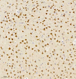 02 GB11138_neun_81117070401 R brain d1000_20.0x_IHC.jpg