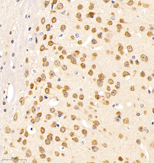 03 GB11138_neun_81117080102 M brain d500_30.0x_IHC.jpg