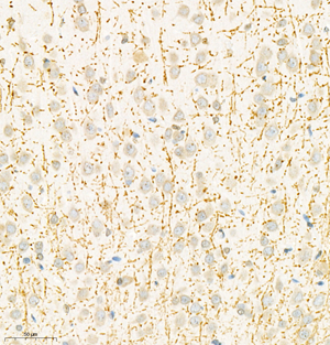 02 GB11226_MBP_20220505 R striatum d600_30.0x_IHC.jpg