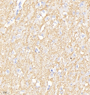 02 GB11553_200601_Synaptophysin_1614_161418050902 M brain d1000_40.0x_IHC.jpg